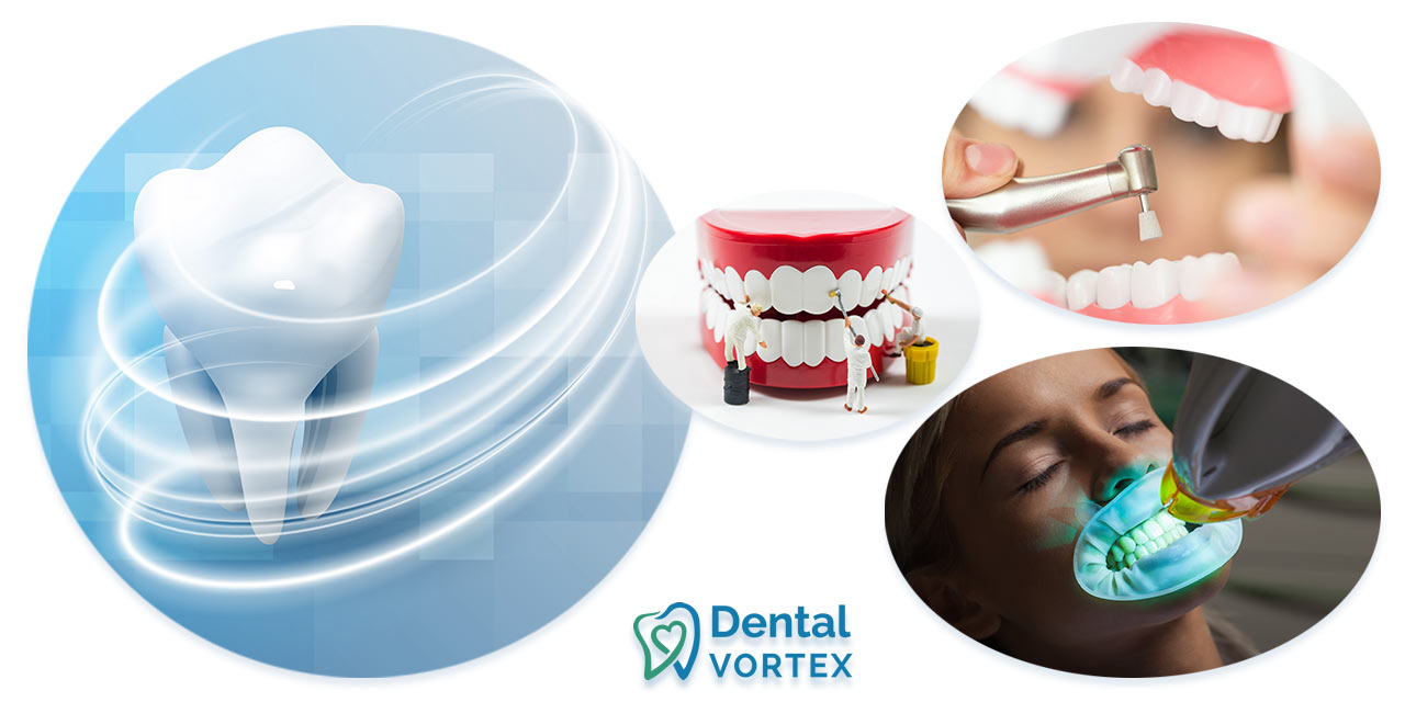 Ilustracije postupaka za uklanjanje belih mrlja na zubima: čišćenje, izbeljivanje, ICON tretman.